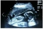 Avatar de pusaki2000